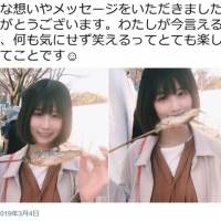有村藍里、美容整形後の写真が「すごく可愛い」と話題に